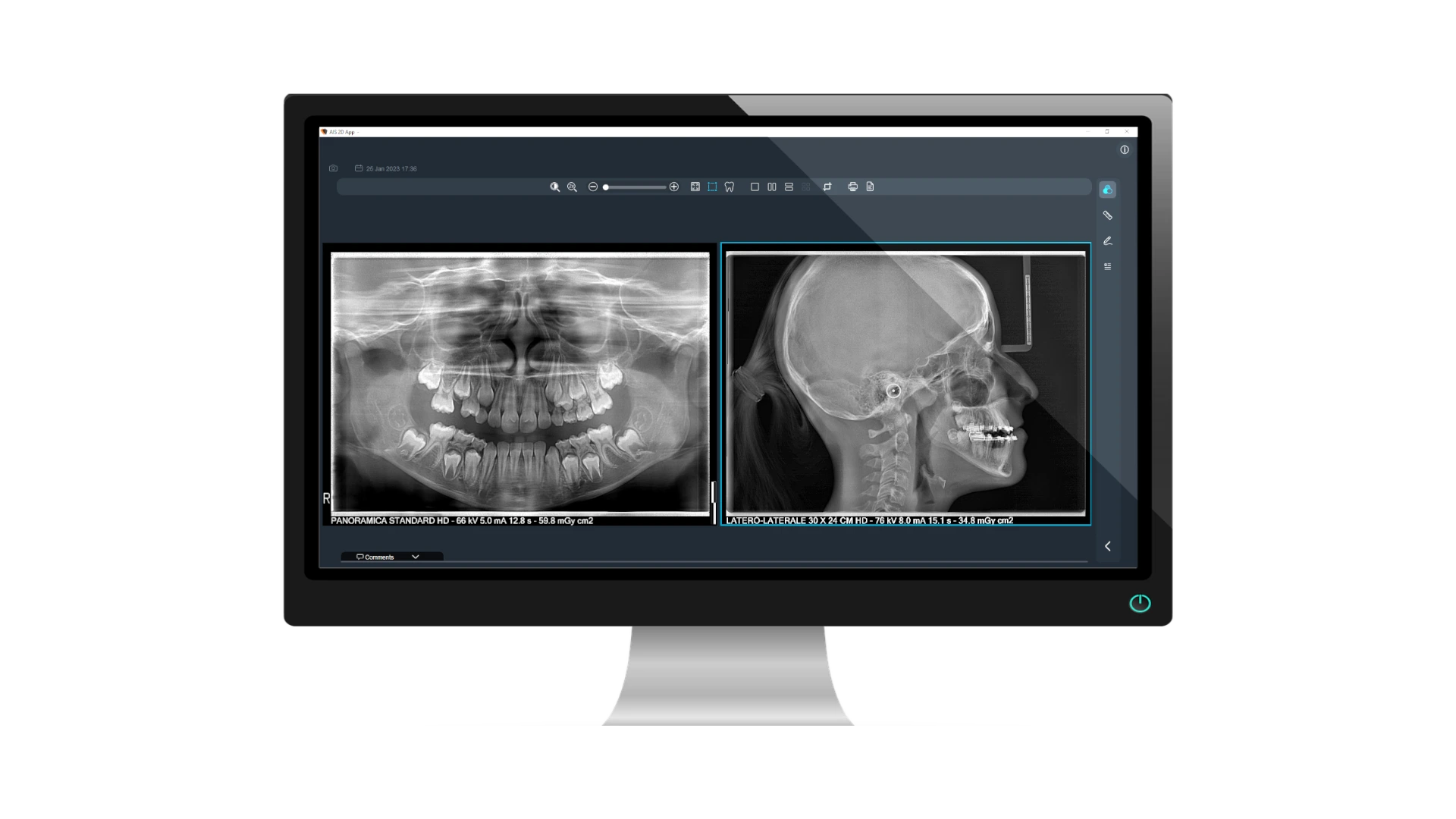 Acteon X-Mind Prime 3D CBCT