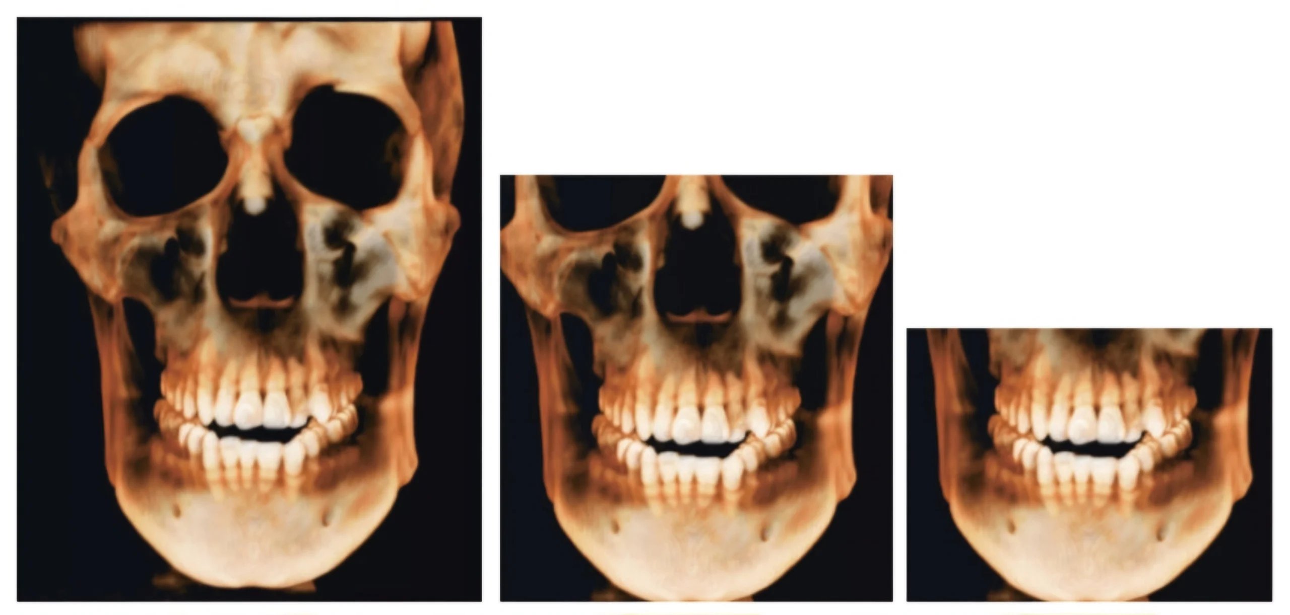 Field of view cbct