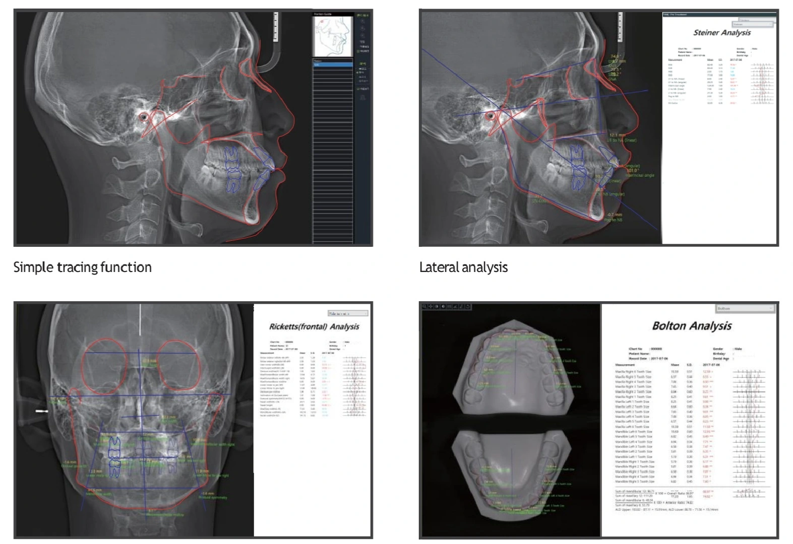 Cbct software