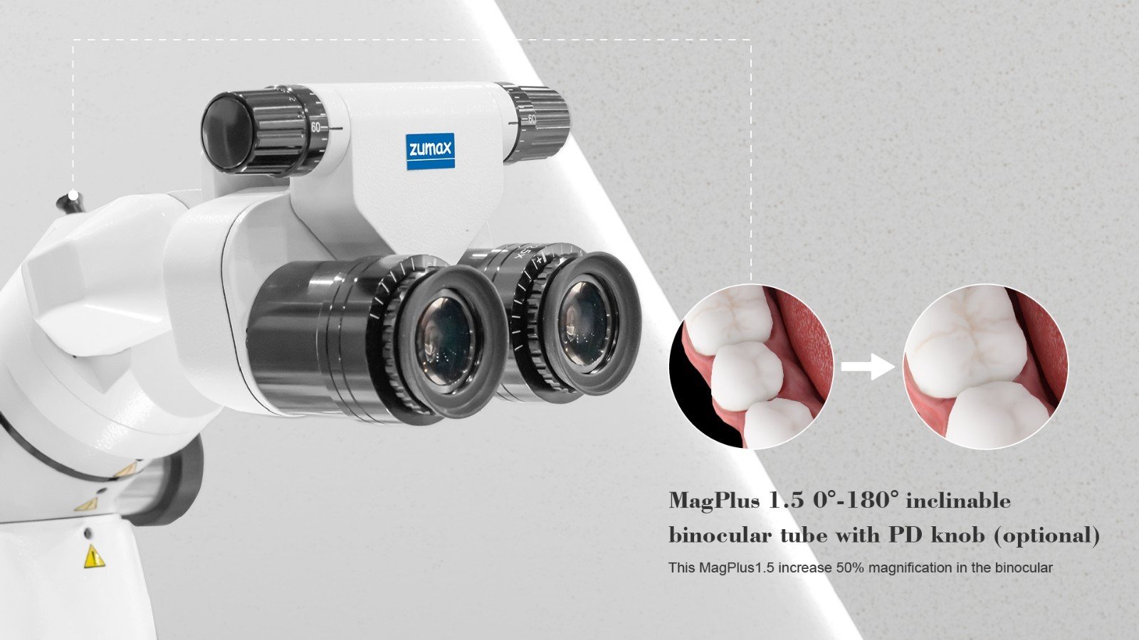 الفلاتر المتكاملة والكاميرا فائقة الوضوح